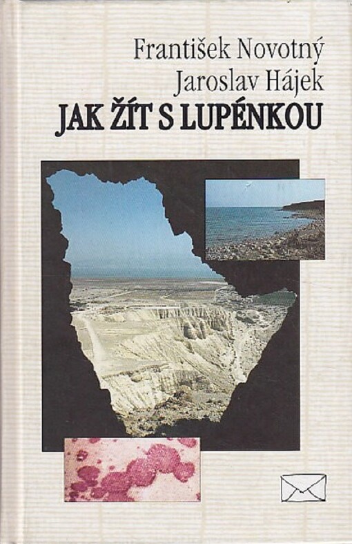 Jak žít s lupénkou