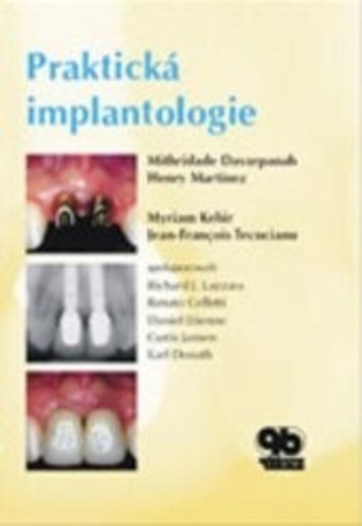 Praktická implantologie