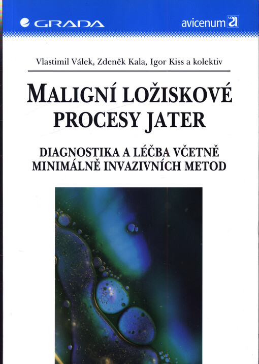 Maligní ložiskové procesy jater : diagnostika a léčba včetně minimálně invazivních metod