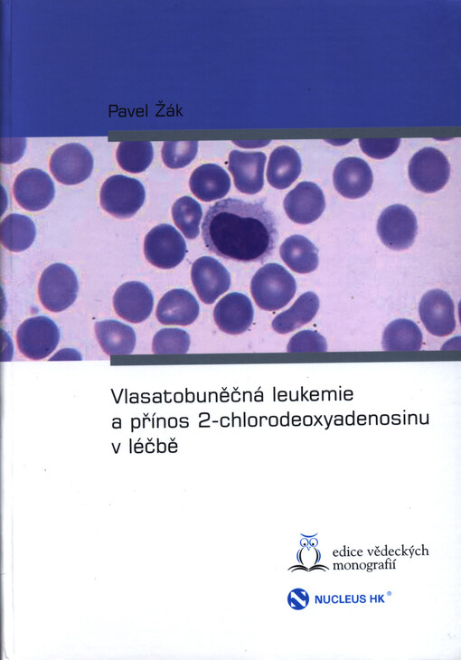 Vlasatobuněčná leukemie a přínos 2-chlorodeoxyadenosinu v léčbě