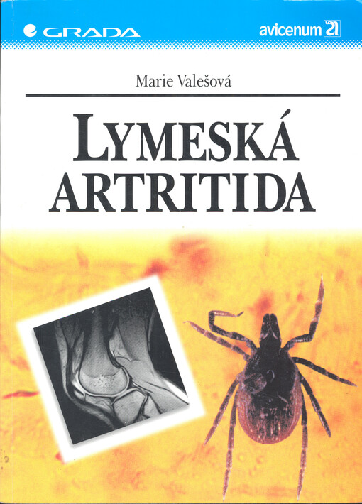 Lymeská artritida