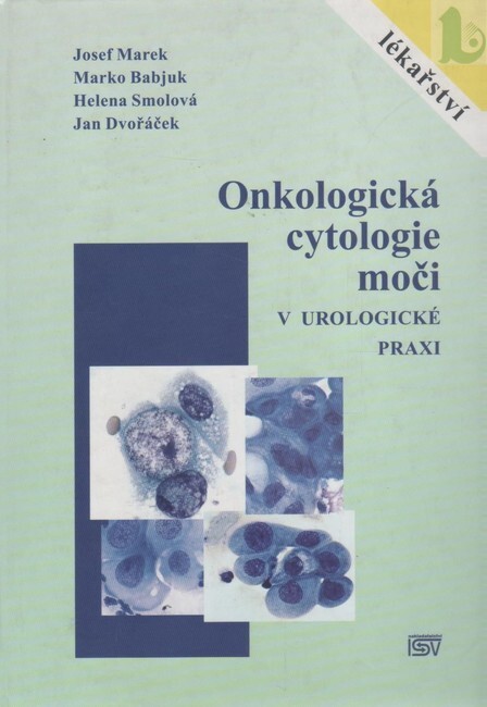 Onkologická cytologie moči v urologické praxi
