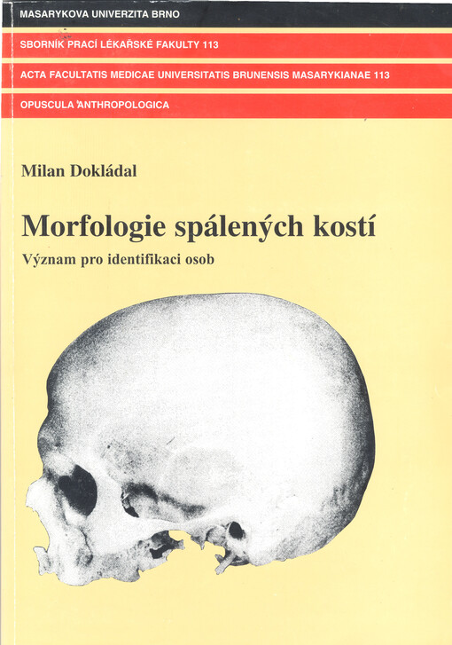 Morfologie spálených kostí : význam pro identifikaci osob = Morphology of burned bones : importance for personal identification