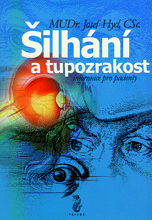 Šilhání a tupozrakost : informace pro pacienty