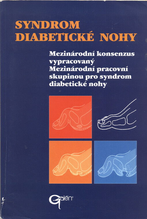 Syndrom diabetické nohy : mezinárodní konsenzus vypracovaný Mezinárodní pracovní skupinou pro syndrom diabetické nohy