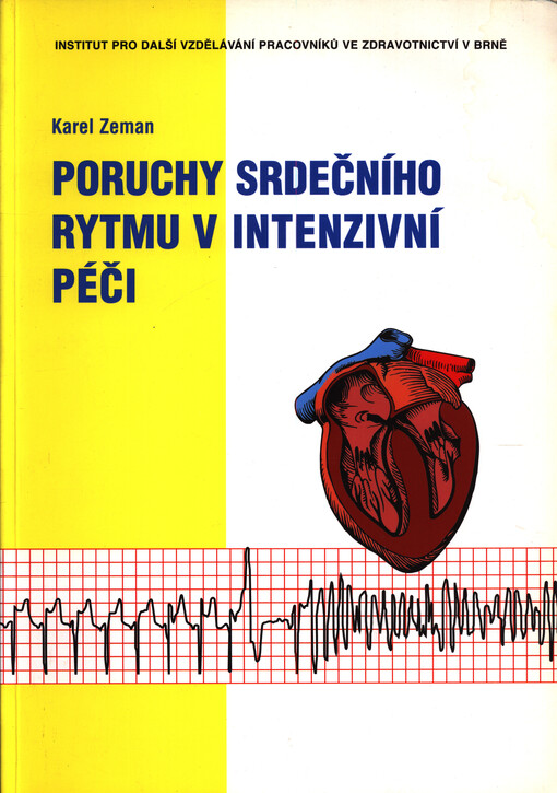 Poruchy srdečního rytmu v intenzivní péči