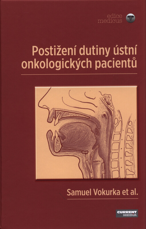 Postižení dutiny ústní onkologických pacientů