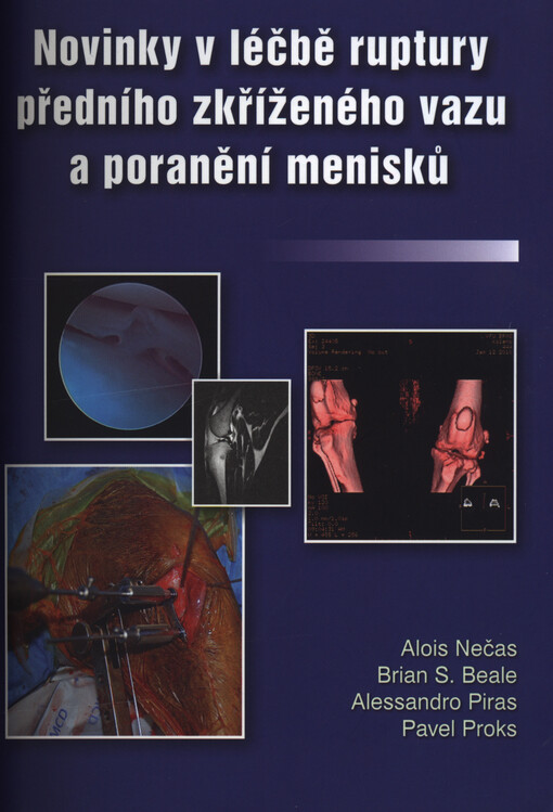 Novinky v léčbě ruptury předního zkříženého vazu a poranění menisků