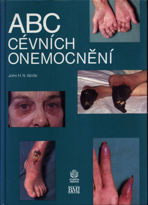 ABC cévních onemocnění