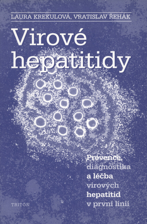 Virové hepatitidy: prevence, diagnostika a léčba virových hepatitid v první linii