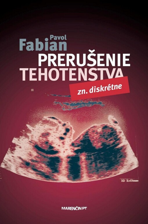Prerušenie tehotenstva Zn:diskrétne