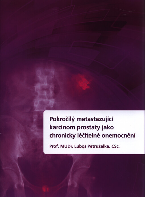 Pokročilý metastazující karcinom prostaty jako chronicky léčitelné onemocnění