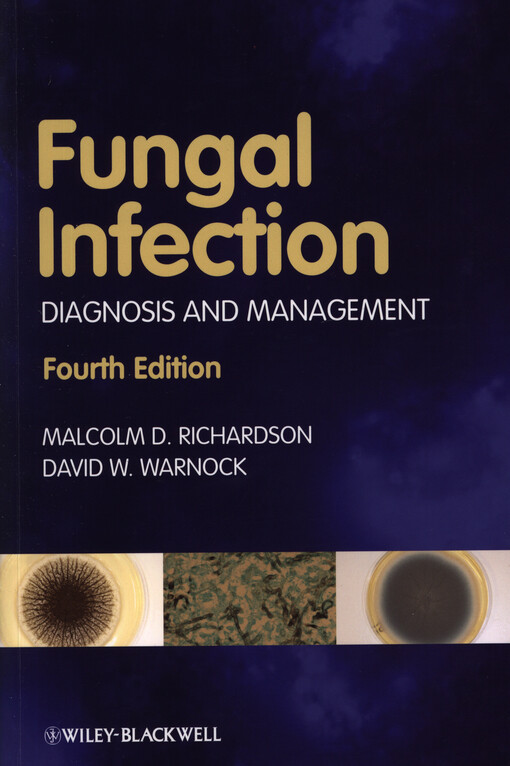 Fungal infection :diagnosis and management