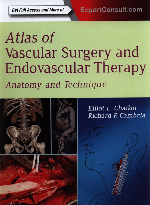 Atlas of vascular surgery and endovascular therapy :anatomy and technique