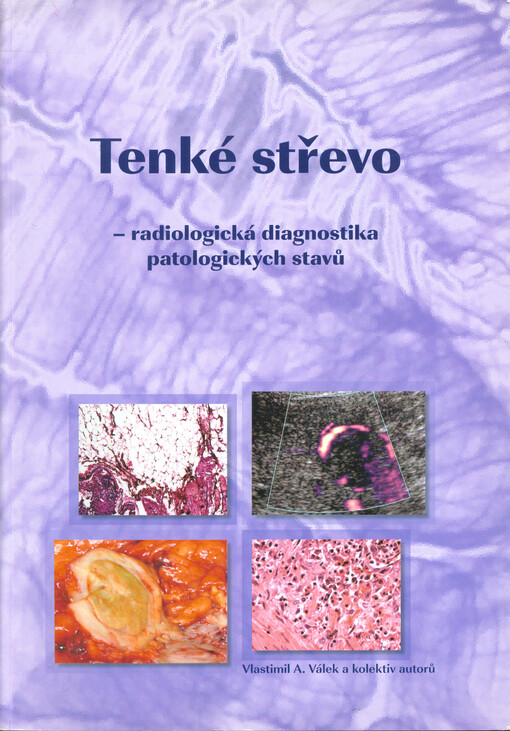 Tenké střevo: radiologická diagnostika patologických stavů